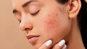 Nurturing Radiance: The Essence of Sensitive Face Care Products